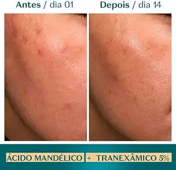 Serum de alta potencia ácido mandelico + tranexamico 5% Botik 30 ml - Imagen 2