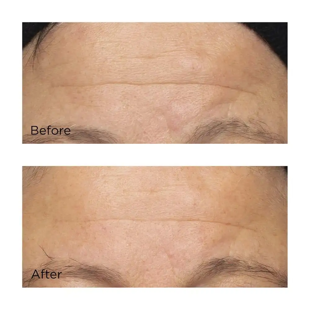 PERRICONE - COLD PLASMA PLUS+ - EL COMPLEJO HIDRATANTE INTENSIVO (59ml) - Imagen 4