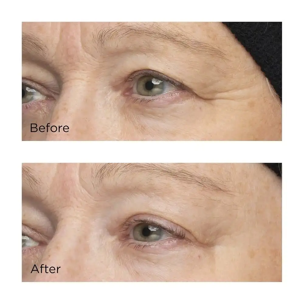 PERRICONE - COLD PLASMA PLUS+ - EL COMPLEJO HIDRATANTE INTENSIVO (59ml) - Imagen 5