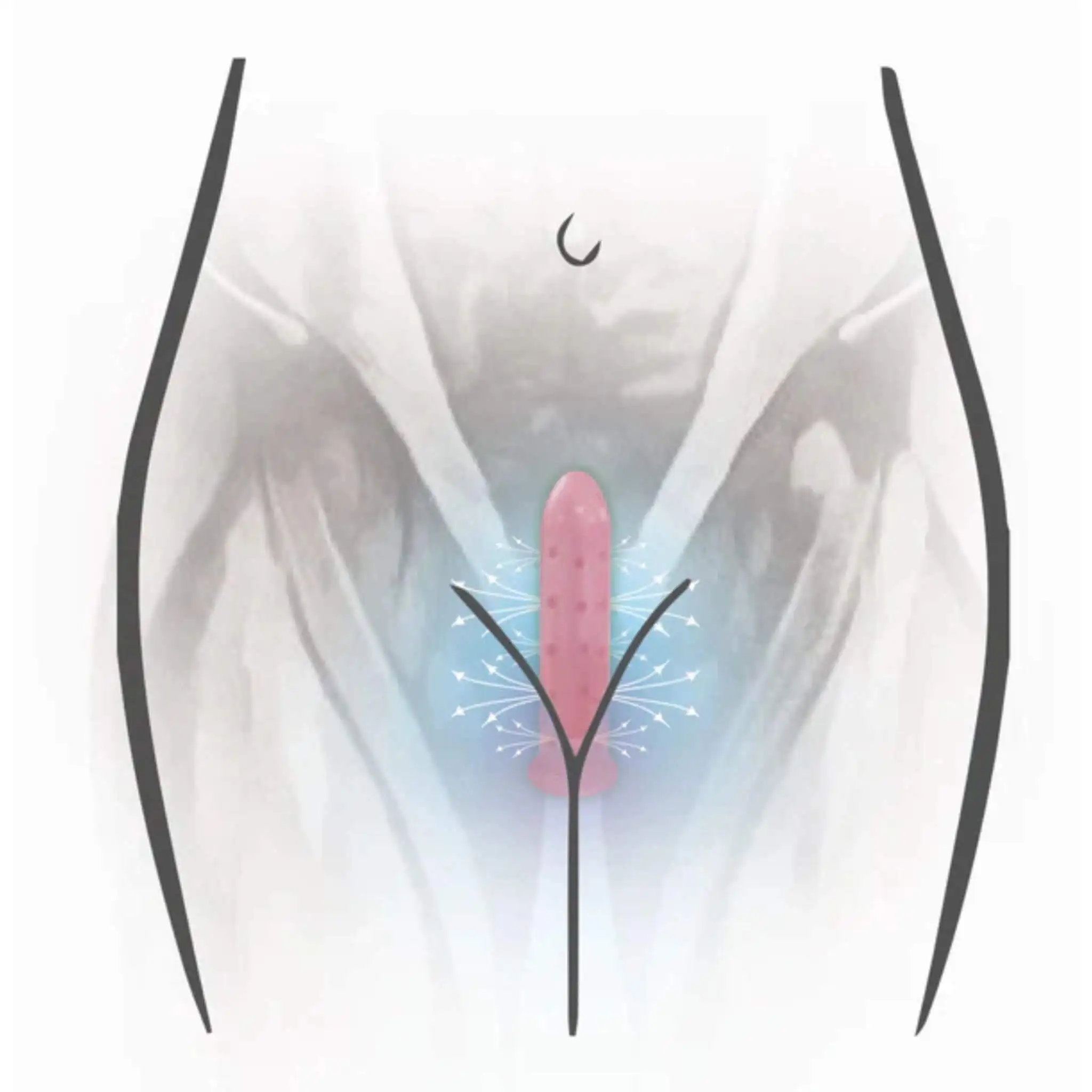 VUVATECH Magnetic Dilator Size 2 - Image 2